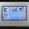 Q switch nd yag system laser tattoo removal machine BM19