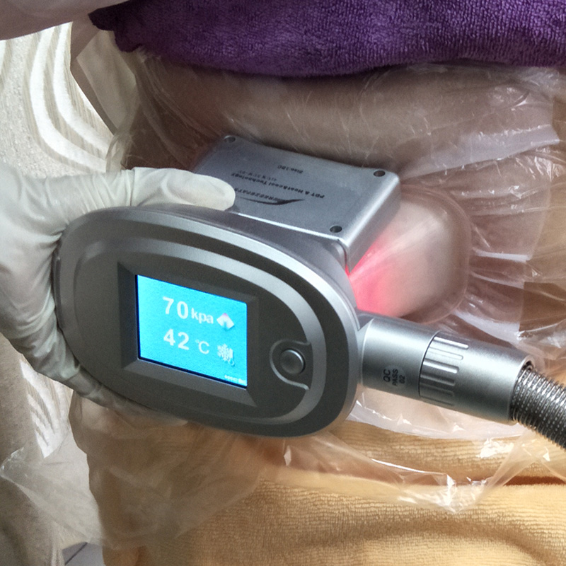 Cryolipolysis Freezing Fat Machine for Weight Loss