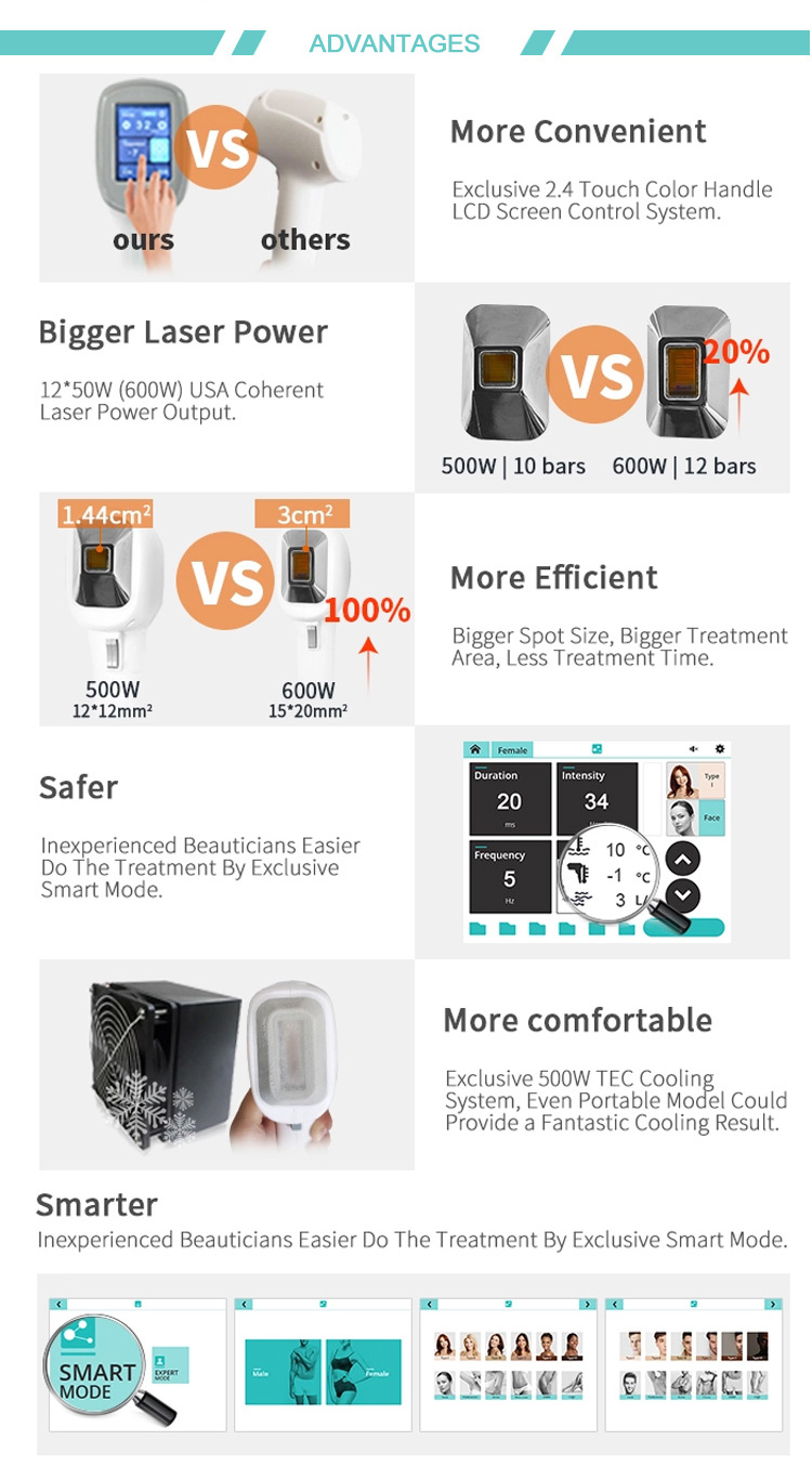 diode laser hair removal